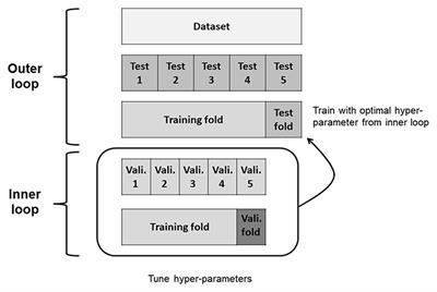 Comparison of Machine Learning Models for Prediction of Initial Intravenous Immunoglobulin Resistance in Children With Kawasaki Disease